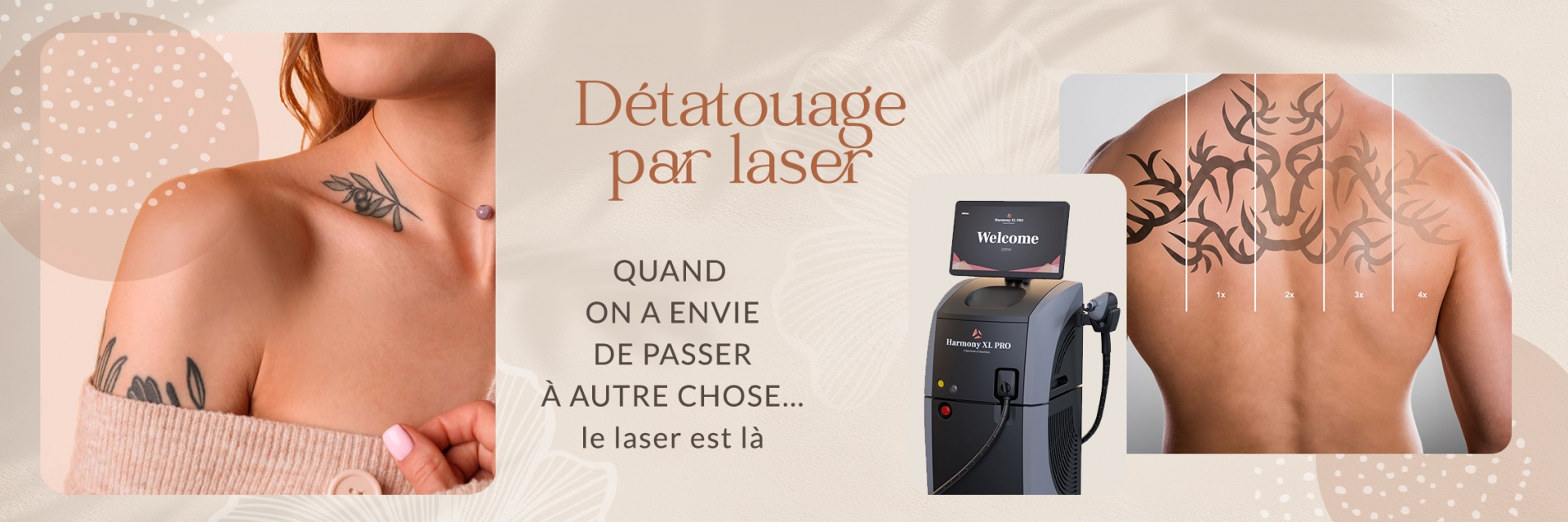 Laser détatouage