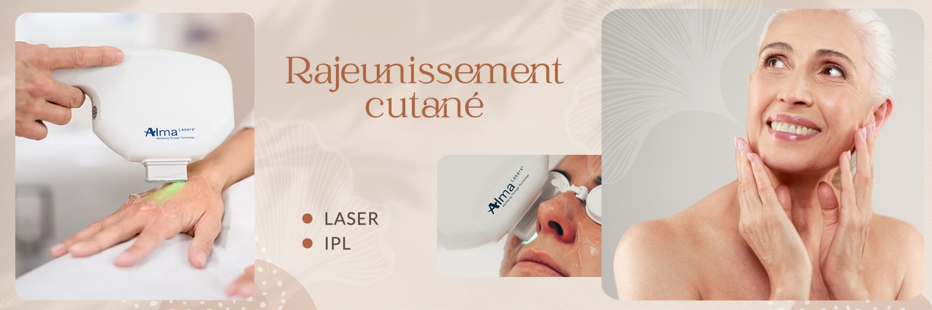 Rajeunissement